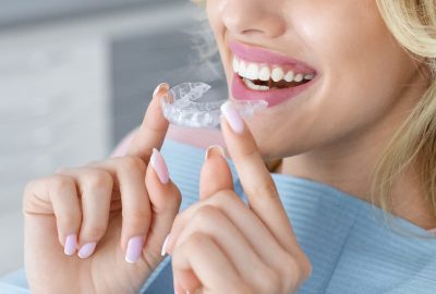 Banner for invisalign orthodontics, modern dentistry concept. Unrecognizable blonde woman with healthy white teeth holding invisible braces while sitting at dental chair, closeup portrait, copy space
